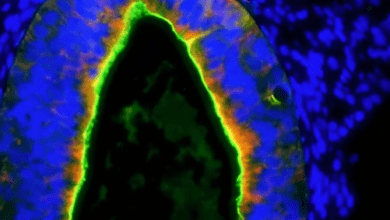 CRISPR Breakthrough Unlocks Potential Cure for Rare Disease, Paving the Way to Longer Lives!”