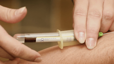 Scientists Develop New Blood Test for Detecting Rare Forms of Dementia and Neurological Diseases